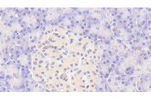 Detection of CASP9 in Human Pancreas Tissue using Polyclonal Antibody to Caspase 9 (CASP9) (Caspase 9 Antikörper  (AA 331-416))