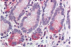 anti-Tyrosyl-DNA Phosphodiesterase 1 (TDP1) (AA 1-298) antibody