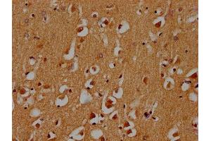 IHC image of ABIN7171265 diluted at 1:300 and staining in paraffin-embedded human brain tissue performed on a Leica BondTM system.