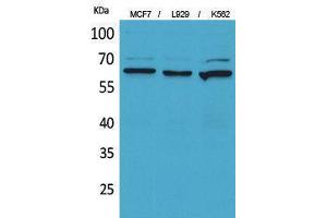 Western Blotting (WB) image for anti-5'-Nucleotidase, Ecto (CD73) (NT5E) (Internal Region) antibody (ABIN3178285) (CD73 Antikörper  (Internal Region))