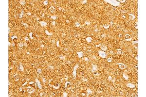 Immunohistochemistry (IHC) image for anti-Myc Proto-Oncogene protein (MYC) (pThr58) antibody (ABIN6256584)
