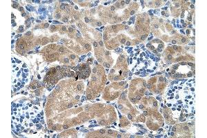 SDCBP antibody was used for immunohistochemistry at a concentration of 4-8 ug/ml to stain Epithelial cells of renal tubule (arrows) in Human Kidney. (SDCBP Antikörper)