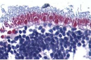 Immunohistochemistry (Paraffin-embedded Sections) (IHC (p)) image for anti-Apoptosis-Inducing Factor, Mitochondrion-Associated, 1 (AIFM1) (Intermediate Domain) antibody (ABIN499237)