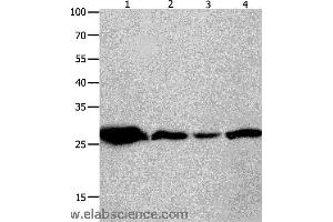 Western blot analysis of Mouse brain tissue, A549 cell and human lymphoma tissue, hela cell , using YWHAQ Polyclonal Antibody at dilution of 1:950 (14-3-3 theta Antikörper)
