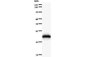 Western Blotting (WB) image for anti-Histidyl-tRNA Synthetase (HARS1) antibody (ABIN933100) (HARS1/Jo-1 Antikörper)