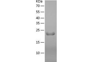 Western Blotting (WB) image for Interferon, omega 1 (IFNW) (AA 24-195) protein (His tag) (ABIN7123509)