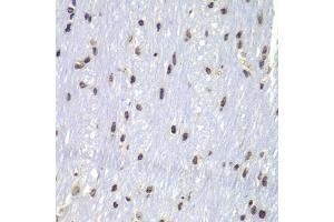 Immunohistochemistry of paraffin-embedded mouse brain using Lyn antibody (ABIN5998158) at dilution of 1/100 (40x lens).