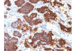Formalin-fixed, paraffin-embedded human Parathyroid Gland stained with PTH Mouse Monoclonal Antibody (PTH/1175). (PTH Antikörper  (AA 32-115))