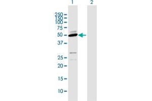 Western Blot analysis of CYP2D6 expression in transfected 293T cell line by CYP2D6 MaxPab polyclonal antibody. (CYP2D6 Antikörper  (AA 1-497))