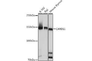 CARD11 Antikörper