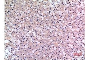 Immunohistochemical analysis of paraffin-embedded human-liver, antibody was diluted at 1:100. (CMTM6 Antikörper  (C-Term))