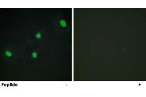Immunofluorescence analysis of HepG2 cells, using CDCA4 polyclonal antibody . (CDCA4 Antikörper)