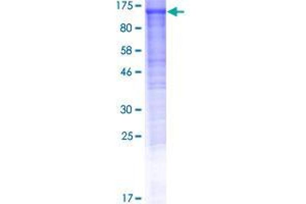 DDHD1 Protein (AA 1-872) (GST tag)