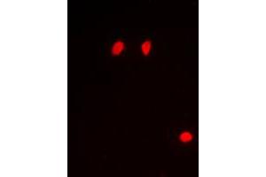 Immunofluorescent analysis of Histone H3 (pS10) staining in Raw264.