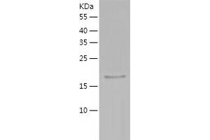 Western Blotting (WB) image for Peroxiredoxin 3 (PRDX3) (AA 63-256) protein (His tag) (ABIN7124363) (Peroxiredoxin 3 Protein (PRDX3) (AA 63-256) (His tag))