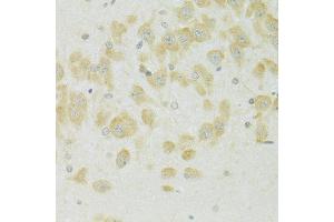 Immunohistochemistry of paraffin-embedded rat brain using SLC37 antibody (ABIN7270453) at dilution of 1:100 (40x lens). (SLC37A4 Antikörper  (C-Term))