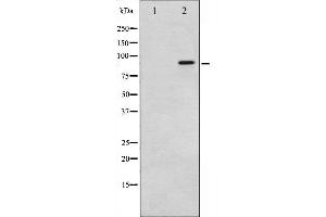 Western blot analysis of p95/NBS1 phosphorylation expression in Jurkat whole cell lysates,The lane on the left is treated with the antigen-specific peptide. (Nibrin Antikörper  (pSer343))
