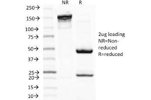 SDS-PAGE Analysis Purified MITF Mouse Monoclonal Antibody (D5). (MITF Antikörper)