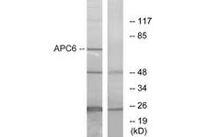 Western blot analysis of extracts from NIH-3T3 cells, using APC6 Antibody. (CDC16 Antikörper  (AA 181-230))