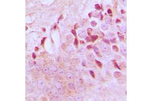 Immunohistochemistry (IHC) image for anti-Tuberous Sclerosis 2 (TSC2) (C-Term), (pSer1462) antibody (ABIN7299518)