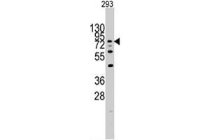 Western blot analysis of DYRK1A polyclonal antibody  in 293 cell line lysates (35 ug/lane). (DYRK1A Antikörper  (N-Term))