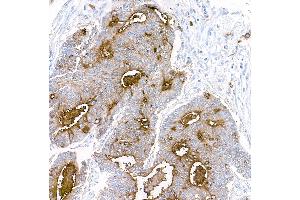 Immunohistochemistry (IHC) image for anti-Carcinoembryonic Antigen-Related Cell Adhesion Molecule 1/5 (CEACAM1/5) (AA 35-433) antibody (ABIN7453963)