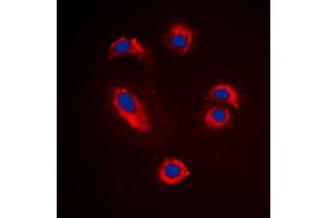 Immunofluorescent analysis of MMP10 staining in Jurkat cells. (MMP10 Antikörper  (C-Term))