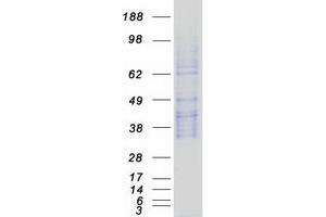 Validation with Western Blot (SPINT2 Protein (Myc-DYKDDDDK Tag))