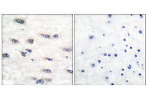 Immunohistochemistry (IHC) image for anti-Neurotrophic Tyrosine Kinase, Receptor, Type 1 (NTRK1) (pTyr791) antibody (ABIN1847224) (TRKA Antikörper  (pTyr791))