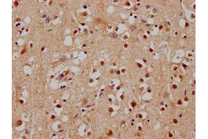IHC image of ABIN7140181 diluted at 1:100 and staining in paraffin-embedded human brain tissue performed on a Leica BondTM system. (SOX1 Antikörper  (AA 49-68))
