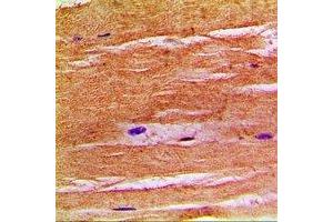 Immunohistochemical analysis of NHE8 staining in human skeletal muscle formalin fixed paraffin embedded tissue section.