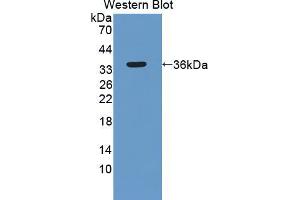 Western blot analysis of the recombinant protein. (SYNE1 Antikörper  (AA 30-283))
