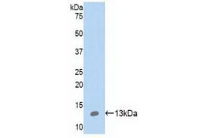 Detection of Recombinant S100A10, Human using Polyclonal Antibody to S100 Calcium Binding Protein A10 (S100A10) (S100A10 Antikörper  (AA 1-96))