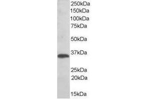Image no. 1 for anti-Thioredoxin-Related Transmembrane Protein 1 (TMX1) (C-Term) antibody (ABIN374090) (TMX1 Antikörper  (C-Term))