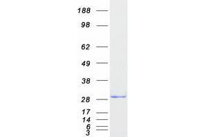 Western Blotting (WB) image for Centromere Protein H (CENPH) protein (Myc-DYKDDDDK Tag) (ABIN2713907)