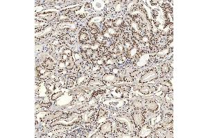 IHC analysis of U1A/SNRPA using anti-U1A/SNRPA antibody (ABIN7600891). (SNRPA1 Antikörper  (AA 25-218))