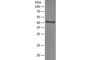 Western Blotting (WB) image for Adenosylhomocysteinase (AHCY) (AA 1-432) protein (His tag) (ABIN7121711)