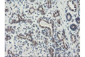 Immunohistochemical staining of paraffin-embedded Human breast tissue using anti-DPH2 mouse monoclonal antibody. (DPH2 Antikörper)