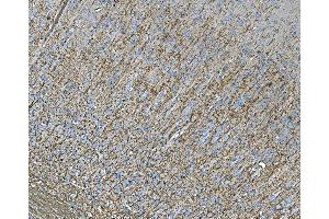 IHC analysis of RAB13 using anti-RAB13 antibody (ABIN7600599).