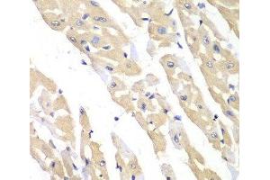 Immunohistochemistry of paraffin-embedded Mouse heart using CCT3 Polyclonal Antibody at dilution of 1:100 (40x lens). (CCT3 Antikörper)