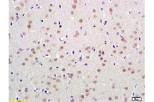 Formalin-fixed and paraffin embedded rat brain labeled with Anti-UBL7 Polyclonal Antibody, Unconjugated  at 1:100 followed by conjugation to the secondary antibody and DAB staining (UBL7 Antikörper  (AA 51-150))