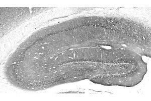 Adult rat hippocampal immunohistochemistry.