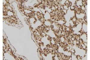 anti-Dishevelled, Dsh Homolog 2 (Drosophila) (DVL2) (C-Term) antibody