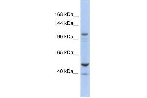 WB Suggested Anti-DDX58 Antibody Titration:  0. (DDX58 Antikörper  (Middle Region))
