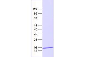 Validation with Western Blot (C20orf166 Protein (His tag))