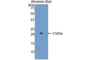 Detection of Recombinant ADAMTS2, Mouse using Polyclonal Antibody to A Disintegrin And Metalloproteinase With Thrombospondin 2 (ADAMTS2) (Adamts2 Antikörper  (AA 855-1030))