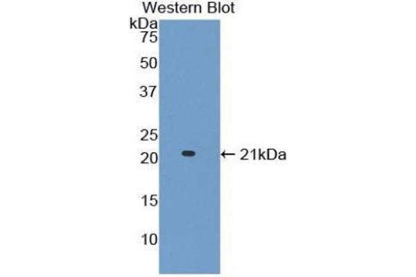 Adamts2 antibody  (AA 855-1030)