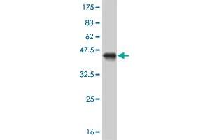Western Blot detection against Immunogen (41. (MED21 Antikörper  (AA 1-144))