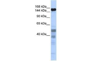WB Suggested Anti-ZNF335 Antibody Titration:  0. (ZNF335 Antikörper  (Middle Region))