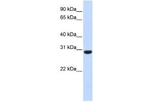 WB Suggested Anti-RCAN1 Antibody Titration:  0. (RCAN1 Antikörper  (Middle Region))